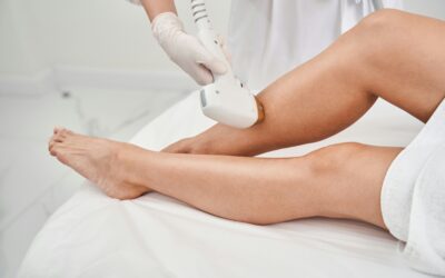 How Laser Hair Removal Is More Effective Than Waxing
